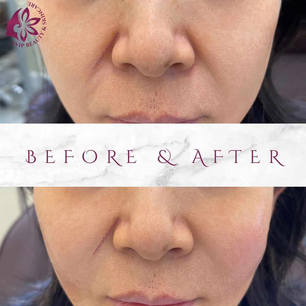 Before and after skin treatment